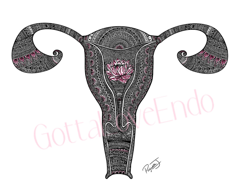 Designer Uterus